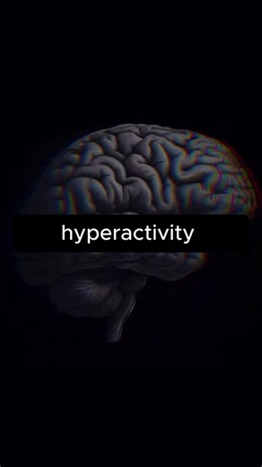 Your ADHD Guide on Instagram: "How ADHD affects the brain scientifically 🧪 ⸻⸻⸻ 🧠 ADHD affects how you plan, prioritize, and follow through — not your intelligence or drive. When you understand the why, strategies start to stick. 📘 We teach evidence-based methods that bridge knowledge and real-life change. 👉 Follow @youradhdguide for ADHD education grounded in science, not shame. . . . . Thanks video @abeautifulmind5 on TT #adhdawareness #adhd #mentalhealth #adhd #adultadhd #adhdbrain #adhd #