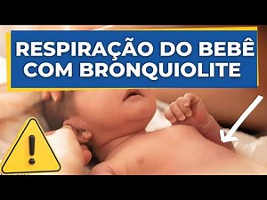 BREATHING OF BABY WITH BRONCHIOLITIS I EMERGENCY 🚨