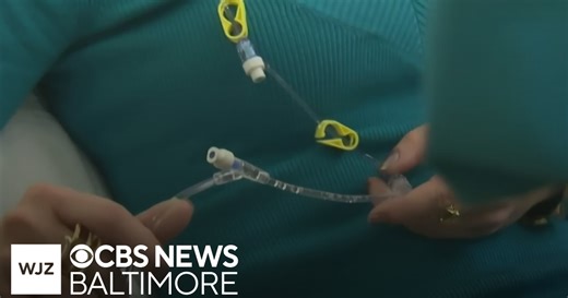 5-year survival rate for all cancers reaches 70% study shows.