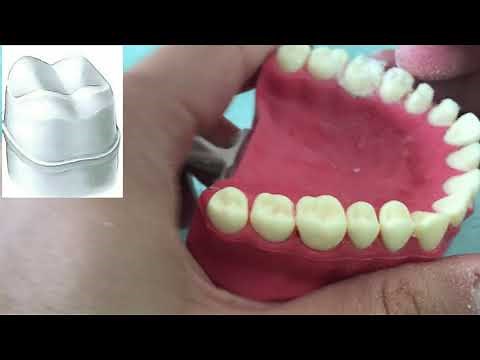 CROWN PREPARATION TUTORIAL (MAXILLARY MOLAR)