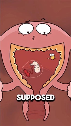 When a Mom Gets Pregnant Twice at Once 🤰👶..!!#e2dhealth #animation #2dshow #fypシ #health
