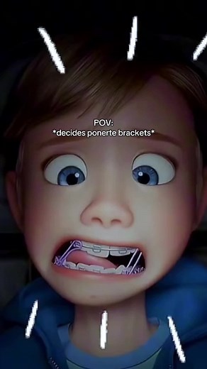 ¿Listo para poner brackets? 😳😍