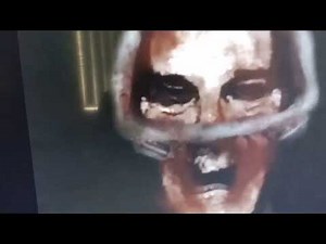 Spring lock failer fixed