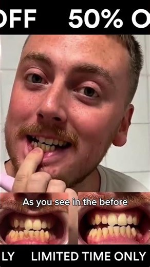 Effortless Plaque Removal