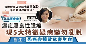 健康診症室｜癦痣屬良性腫瘤　現5大特徵疑病變勿亂脫　醫生：恐癌變擴散危害生命