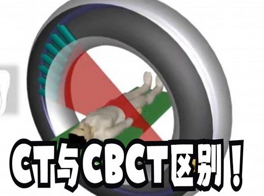 CT与CBCT的区别