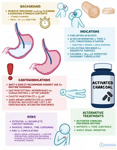 Gastric Lavage: What Is It and How It Is Done | Osmosis