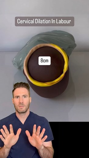1.8M views · 6.4K reactions | During labor, the cervix undergoes dilation to allow for the passage of the baby from the uterus to the birth canal. This process occurs in stages, starting with early labor when the cervix dilates from 0 to 3 cm, progressing to active labor with dilation from 4 to 7 cm, and culminating in the transition phase where dilation reaches 8 to 10 cm.#laboranddelivery #givingbirth #pregnant #whattoexpectwhenyoureexpecting #firstpregnancy | Doctor Joe | Facebook