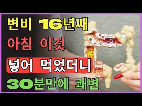 변비 해결법 총정리! 식이섬유보다 중요한 장 건강 습관｜아침 소금물·장운동·발효식품으로 건강한 노후