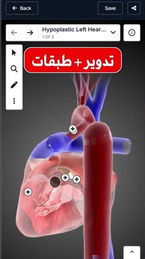 تشريح ثلاثي الأبعاد تفاعلي على BioDigital Human