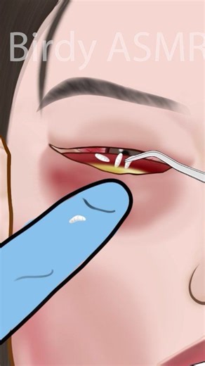 ASMR treatment for bee sting swollen face animation P2 #asmr #animation #asmranimation #satisfying #trending | Birdy ASMR