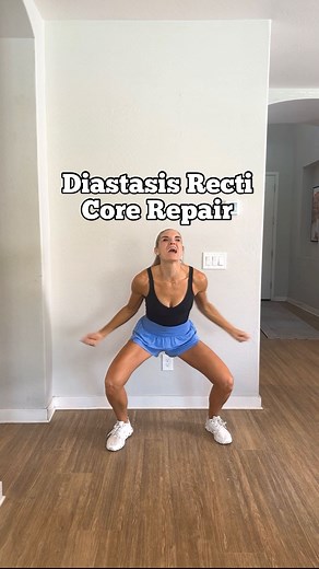 Andrea -Mom Fitness: Nutrition- Hormones-Diastasis | Diastasis Recti aka the “mommy tummy/pooch” is when the linea alba which runs down the center of the core stretches and thins creating a... | Instagram