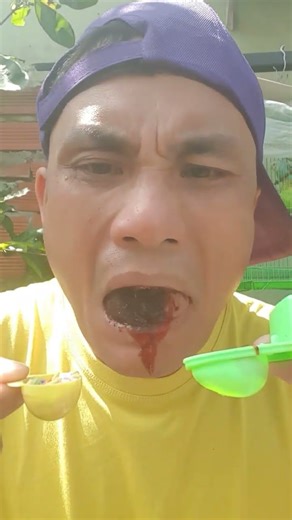 Adu suara bareng Canal Kimberlly e Kyann, Cool Items and my suara koper koperan👋🥵🤮