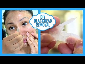 DIY BLACKHEAD REMOVAL! DIY Biore Pore Strips! Does it work?