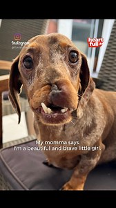 Dachshund Attacked by Two Big Dogs Survived and is now back to her Old Happy Self