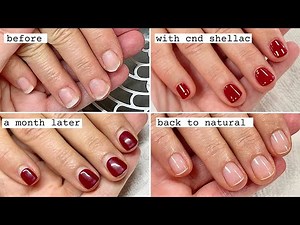 Gentle Shellac Removal and Manicure [How nail shape can change after polish wear]