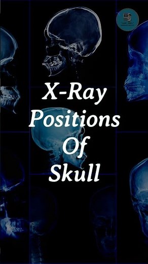 X-ray positions of skull | X-ray #Radiiologyinsights #radiology #xray #shorts
