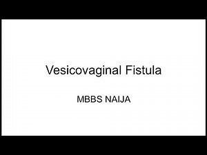 Vesicovaginal Fistula ; Definition, Causes, Symptoms, Diagnosis and Treatment