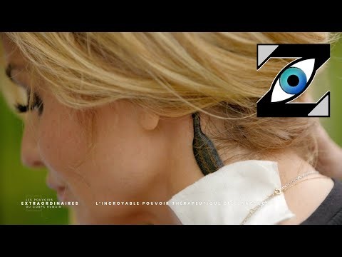 [Zap Télé_2] Des sangsues sur M. Cymes et A. Karembeu pour soulager les douleurs (21/07/23)