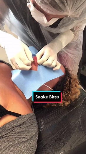 Snake Bites Piercing: A Trendy Look for Body Modification