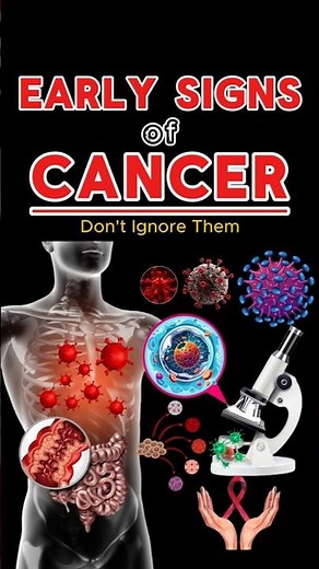 Warning Signs of Cancer Most People Miss