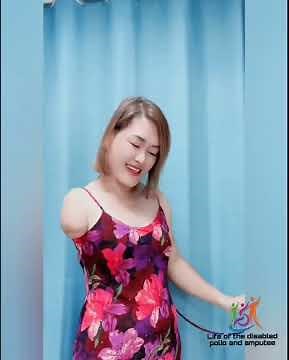 The beautiful woman has an amputated arm and life with one arm #disability