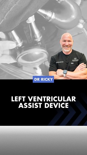 Doctor Ricky | Plastic Surgeon on Instagram: "Left Ventricular Assist Device (LVAD) An LVAD is a mechanical device that helps the left ventricle (the main pumping chamber of the heart) pump blood more effectively. It is used in patients with severe heart failure who are not eligible for a heart transplant or who are waiting for a transplant #heart #lvad #medical #miracle"