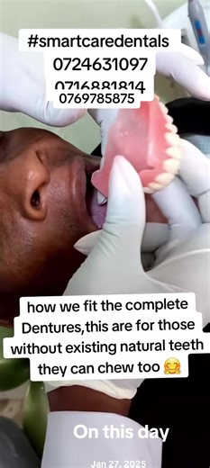 Complete Dentures Fittings Explained on This Day