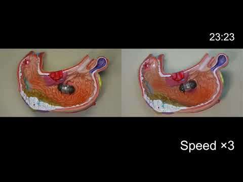 A Low-Friction Capsule Robot with Drive–Control–Sensing Integration for Gastrointestinal Lesion S3