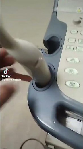 Toshiba Xario Prime Ultrasound Review | High-Resolution Imaging & Features Guide +92320 9531247