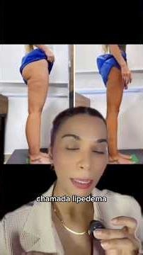 Tudo sobre lipedema, causas e tratamento que você deve saber! #saudedamulher #treino #lipedema