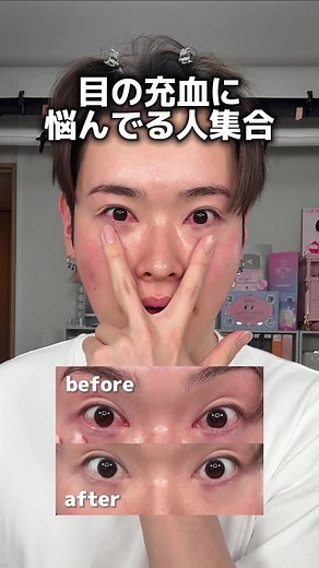 花粉症対策に最適な目薬のレビュー
