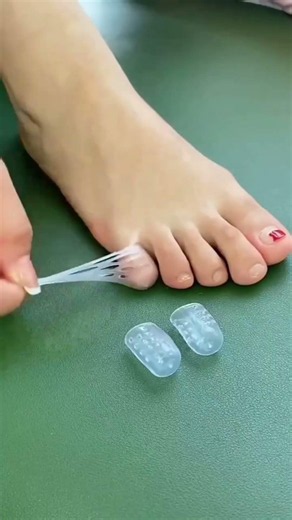 silicone toe protectors