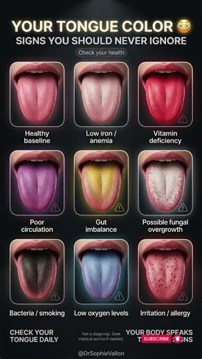 Check your tongue 😱 | these colors could reveal hidden disease! #health #body #wellness #healthtips