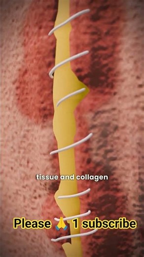 😯 How do self-dissolving stitches work