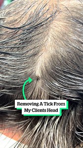 202K views · 170 reactions | Removing A Tick From A Client's Head 﫣 | VT | Facebook