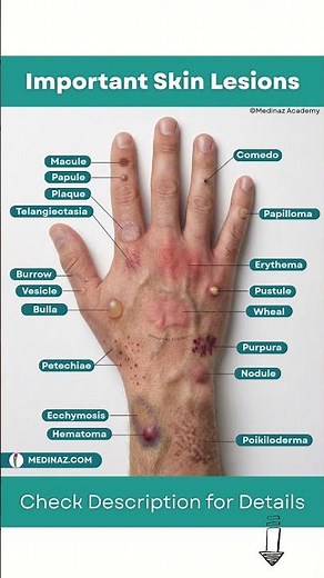 Important Skin Lesions You Should Know | Skin Diseases
