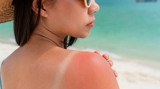 There's no such thing as a safe tan: What to know about summer skin care
