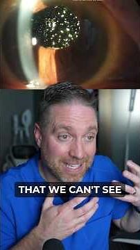 A Lot of Eye Floaters!