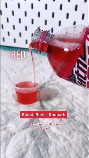 URINE COLORS EXPLAINED 🌈🚽🧻