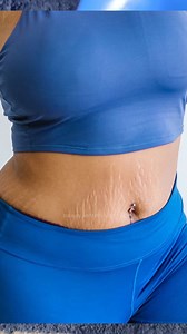 25K views · 40 reactions | Best & Safe beauty hacks to Remove Stretch Marks | Streach Marks Ko Hatane Ka Gharelu Tarika by beauty secrets hindi | Beauty Secrets Hindi | Facebook