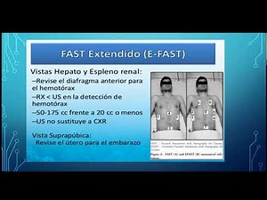 Basic FAST Ultrasound 🩺 | Rapid diagnosis in trauma and emergencies