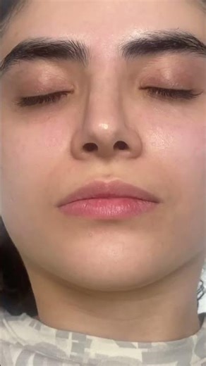 Removing Peach Fuzz & Dead Skin | Real-Time Dermaplaning 💎