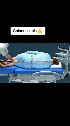 Como é Feita a Colonoscopia: Passo a Passo e Procedimento