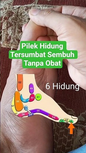 Cara Mengatasi Pilek Hidung Tersumbat