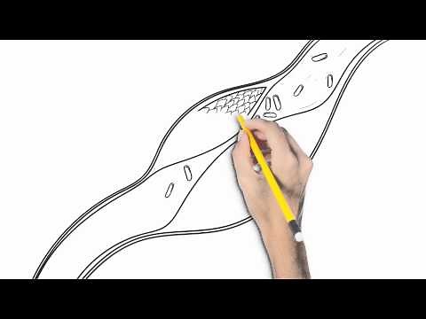 Risk factors for heart disease: Blood pressure