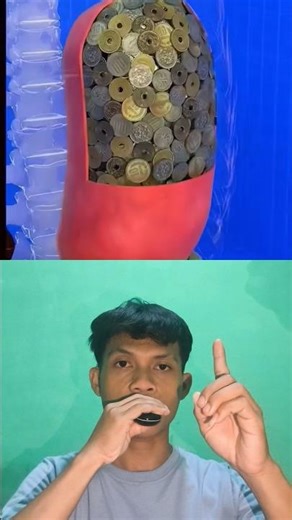 Lambung pria ini penuh dengan uang koin 😱‼️ #short #shortvideo #facts #reaction #trending