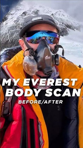 My body before and after climbing Mount Everest