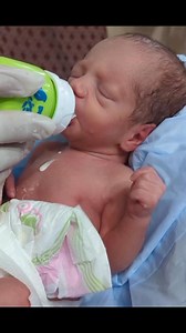 Feeding a 32-week preterm baby is a delicate process that requires strict NICU protocols, continuous monitoring, and evidence-based techniques. At 32 weeks, many babies still develop their sucking, swallowing, and breathing coordination—so safe feeding is essential for healthy growth. This video explains the complete feeding guideline for preterm babies born at 32 weeks. In this video, you will learn: ✔ Feeding readiness in a 32-week preterm baby ✔ When to use NG/OG tube feeding vs. cup feeding