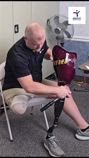 Living Without Thinking About Your Prosthesis